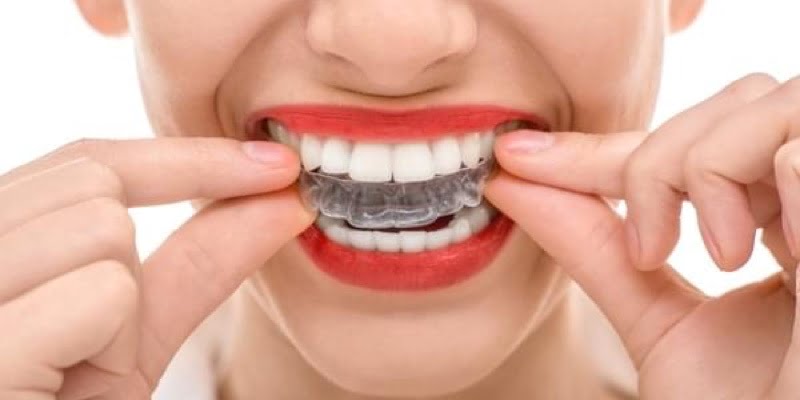 ¿Qué tipo de ortodoncia es mejor?
