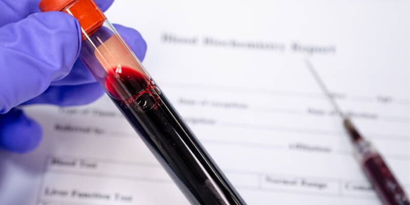 Qué significa y causas del RDW alto o bajo en una analítica de sangre